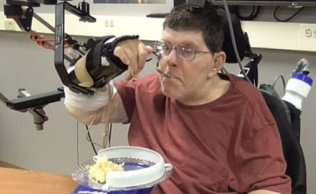 荷兰一瘫痪男子脑内植入信号传导装置后可重新行走 距离普及还有多久？-千呱博客网