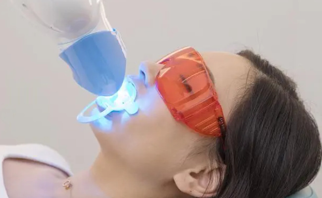 什么是冷光美白牙齿-千呱博客网